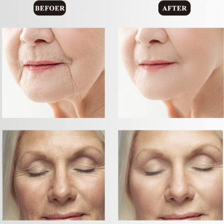 Масажер для обличчя та шиї Ms.W NECK CARE